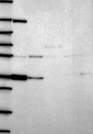 VSIG4 Antibody Western Blot: VSIG4 Antibody [NBP3-25227]