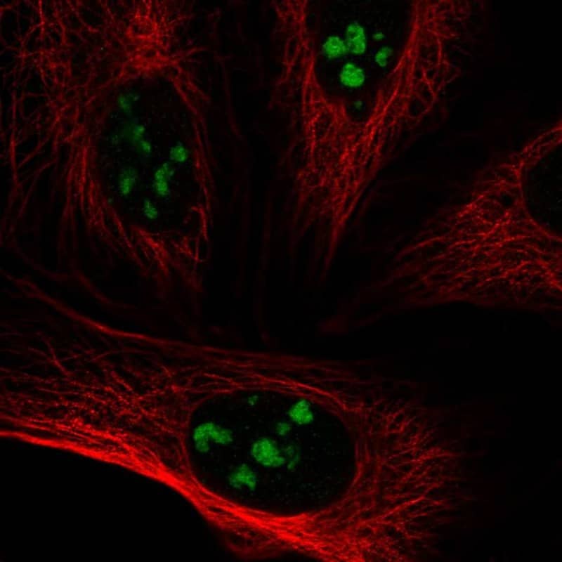 VSX1 Antibody Immunocytochemistry/Immunofluorescence: VSX1 Antibody [NBP3-25228]