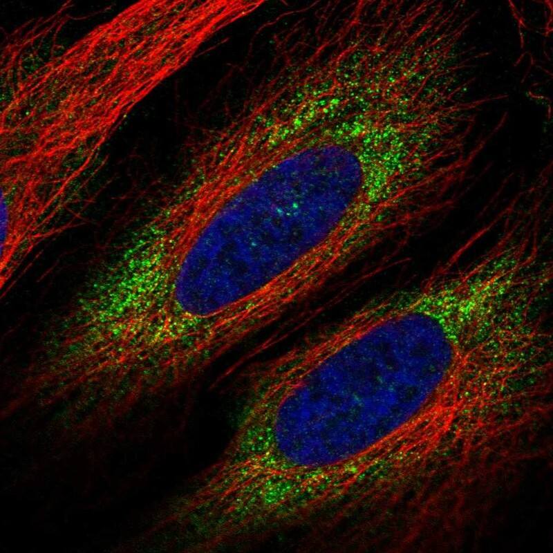 VWDE Antibody Immunocytochemistry/Immunofluorescence: VWDE Antibody [NBP3-25229]