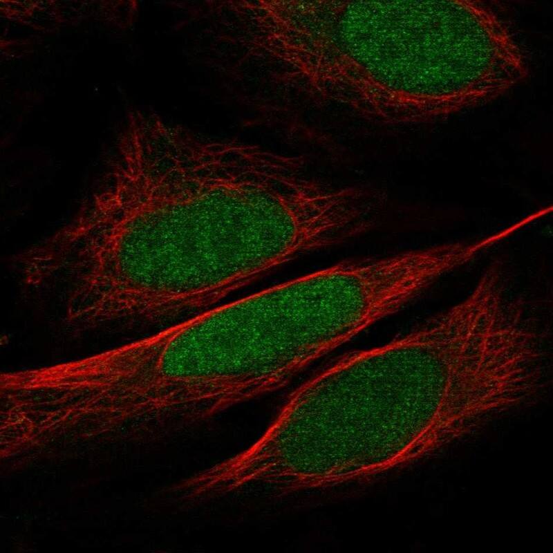 WDR5 Antibody Immunocytochemistry/Immunofluorescence: WDR5 Antibody [NBP3-25231]