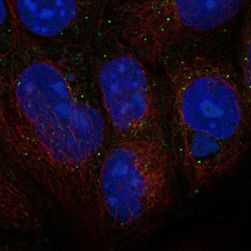 Wnt3 Antibody Immunocytochemistry/Immunofluorescence: Wnt3 Antibody [NBP3-25233]