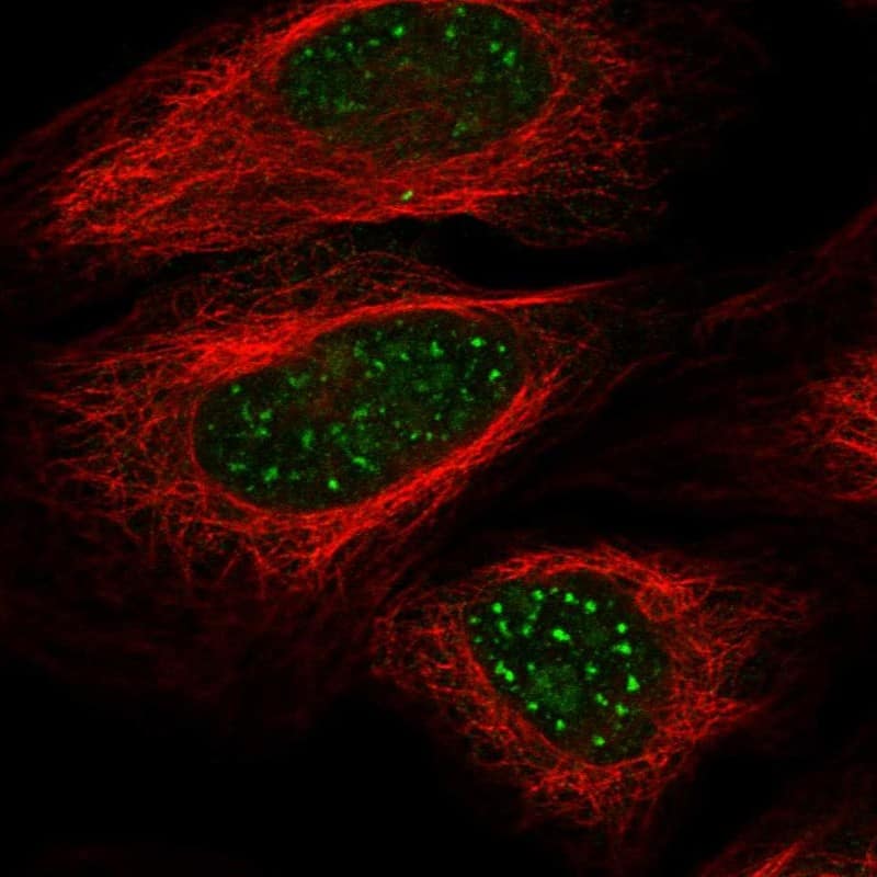 WRN Antibody Immunocytochemistry/Immunofluorescence: WRN Antibody [NBP3-25234]