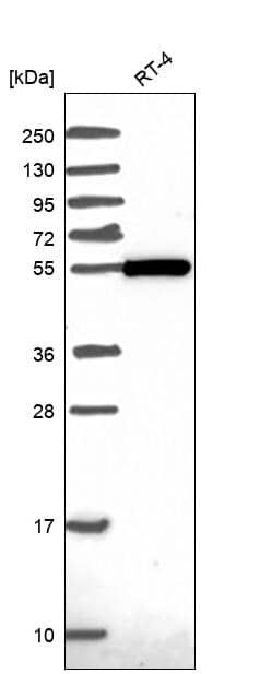 ZBTB46 Antibody Western Blot: ZBTB46 Antibody [NBP3-25237]