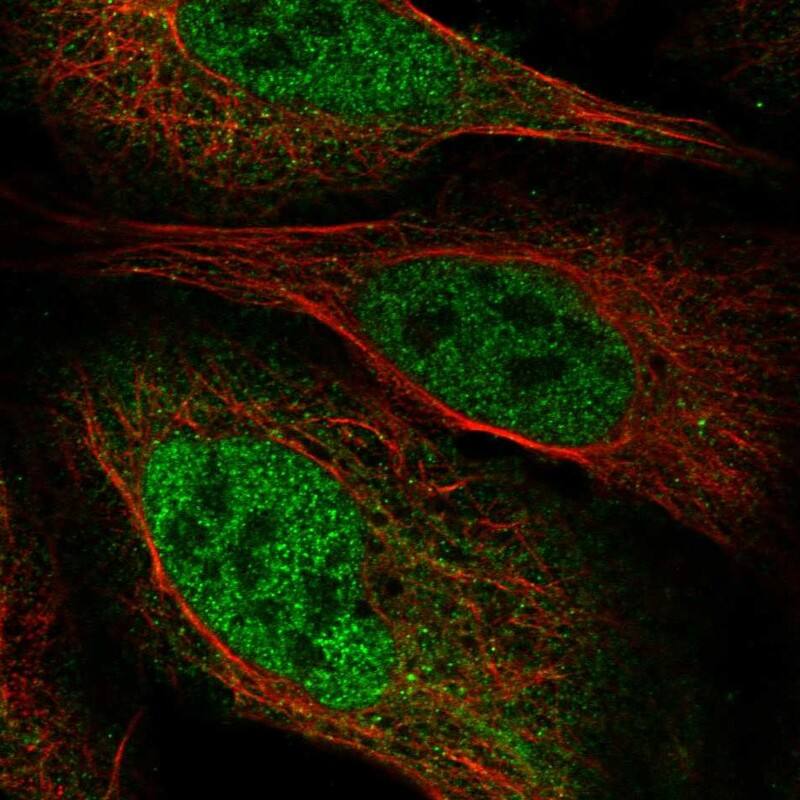 ZBTB8B Antibody Immunocytochemistry/Immunofluorescence: ZBTB8B Antibody [NBP3-25238]