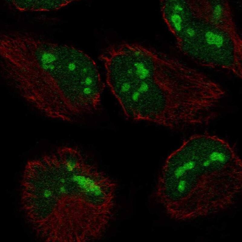 ZCCHC2 Antibody Immunocytochemistry/Immunofluorescence: ZCCHC2 Antibody [NBP3-25239]