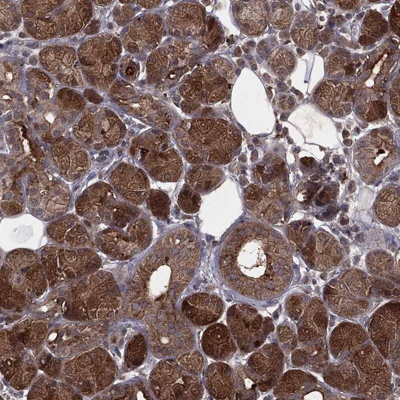 ZDHHC15 Antibody Immunohistochemistry-Paraffin: ZDHHC15 Antibody [NBP3-25240]