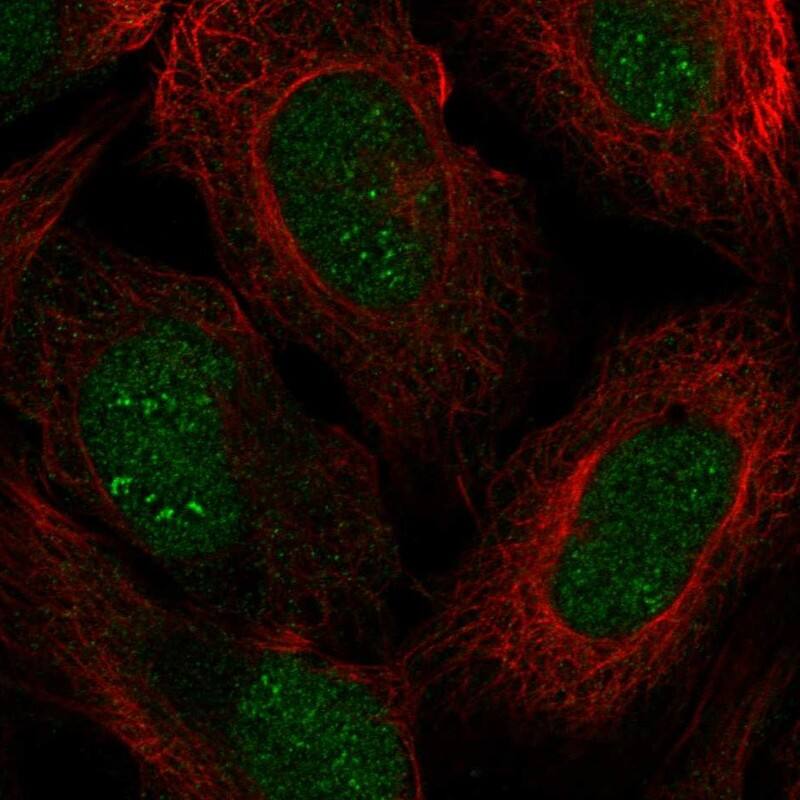 ZFP112 Antibody Immunocytochemistry/Immunofluorescence: ZFP112 Antibody [NBP3-25241]