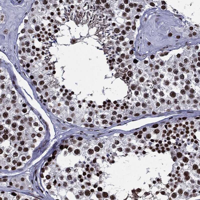 ZFP91 Antibody Immunohistochemistry-Paraffin: ZFP91 Antibody [NBP3-25242]