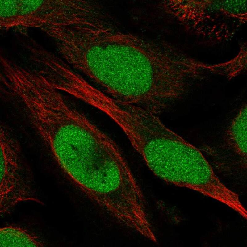 ZGRF1 Antibody Immunocytochemistry/Immunofluorescence: ZGRF1 Antibody [NBP3-25243]