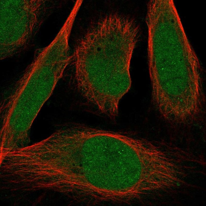 ZMIZ2 Antibody Immunocytochemistry/Immunofluorescence: ZMIZ2 Antibody [NBP3-25244]