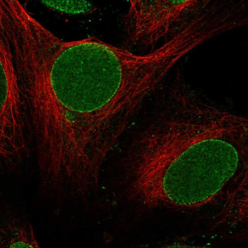 ZNF20 Antibody Immunocytochemistry/Immunofluorescence: ZNF20 Antibody [NBP3-25246]