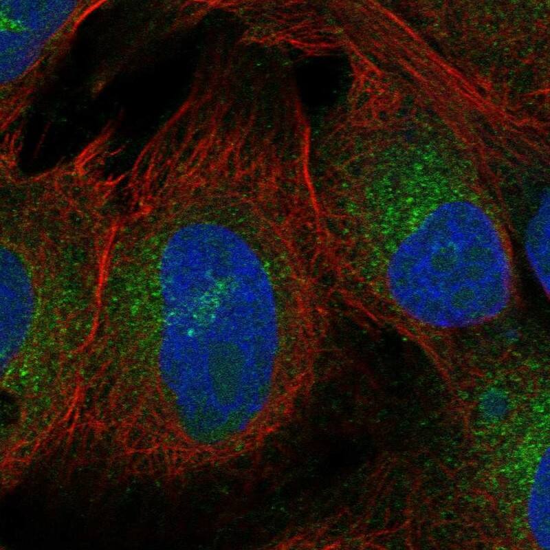 ZNF208 Antibody Immunocytochemistry/Immunofluorescence: ZNF208 Antibody [NBP3-25247]