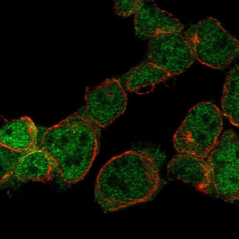 ZNF302 Antibody Immunocytochemistry/Immunofluorescence: ZNF302 Antibody [NBP3-25249]