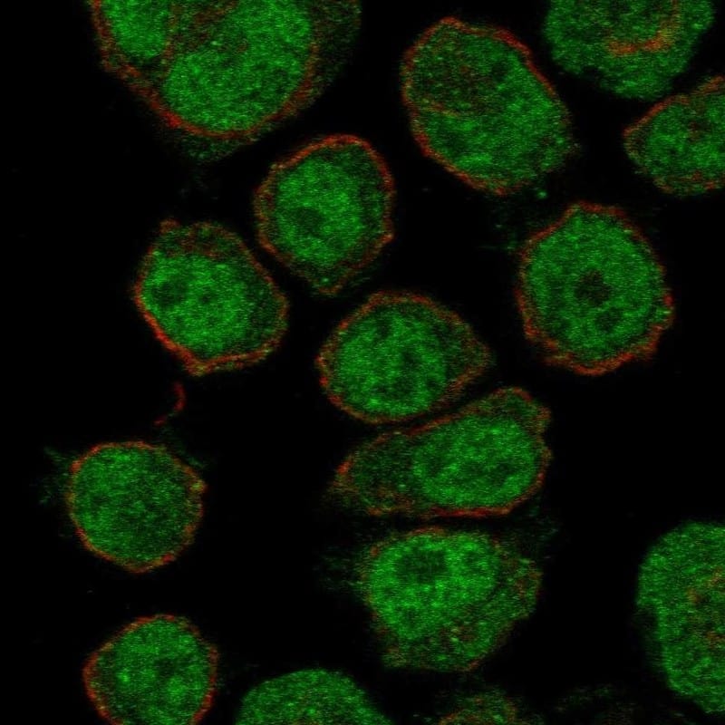 ZNF333 Antibody Immunocytochemistry/Immunofluorescence: ZNF333 Antibody [NBP3-25250]