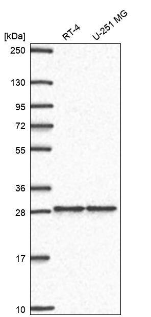 ZNF385 Antibody Western Blot: ZNF385 Antibody [NBP3-25251]