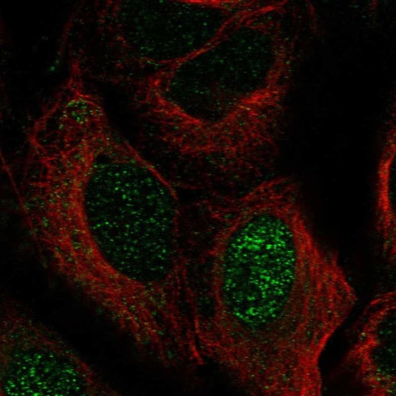 ZNF416 Antibody Immunocytochemistry/Immunofluorescence: ZNF416 Antibody [NBP3-25252]