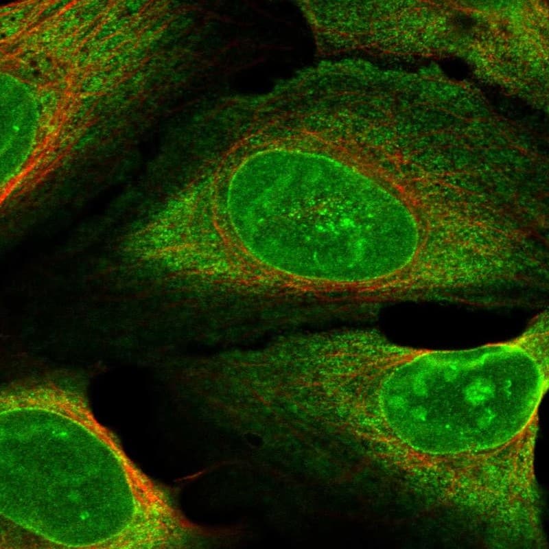 ZNF474 Antibody Immunocytochemistry/Immunofluorescence: ZNF474 Antibody [NBP3-25254]