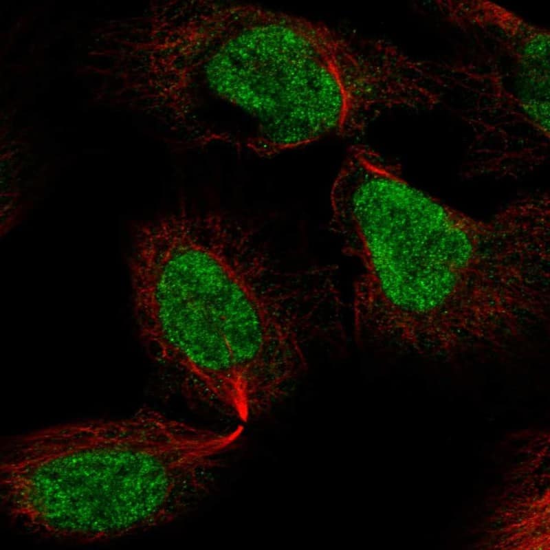 ZNF496 Antibody Immunocytochemistry/Immunofluorescence: ZNF496 Antibody [NBP3-25255]