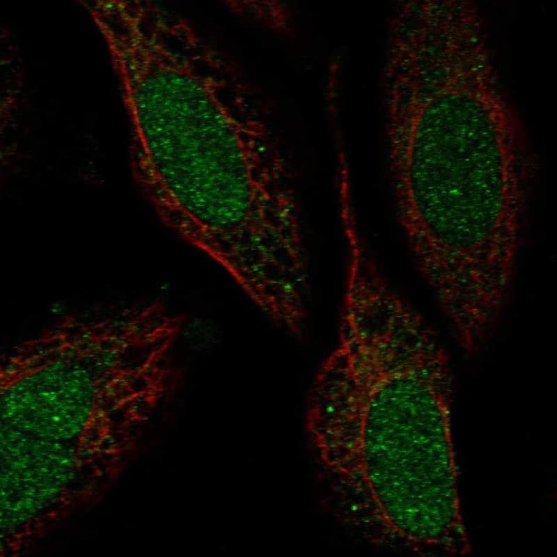 ZNF641 Antibody Immunocytochemistry/Immunofluorescence: ZNF641 Antibody [NBP3-25256]