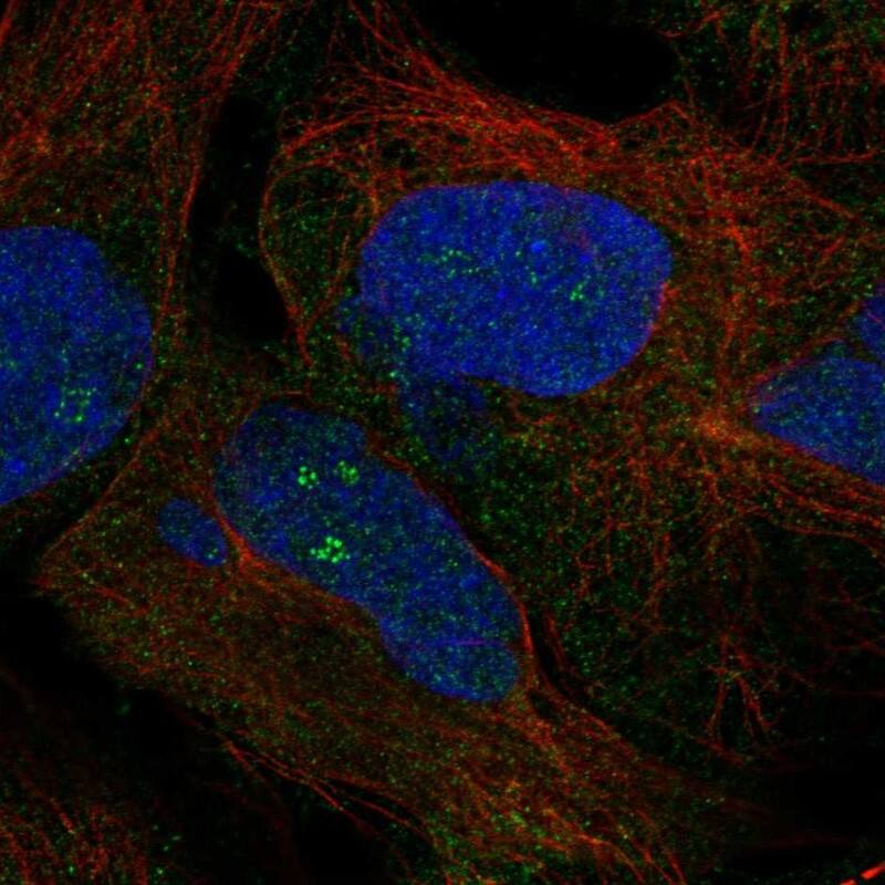 ZNF728 Antibody Immunocytochemistry/Immunofluorescence: ZNF728 Antibody [NBP3-25257]