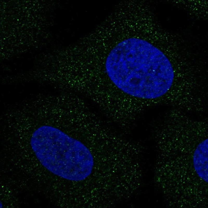 ZnT-8/SLC30A8 Antibody Immunocytochemistry/Immunofluorescence: ZnT-8/SLC30A8 Antibody [NBP3-25259]