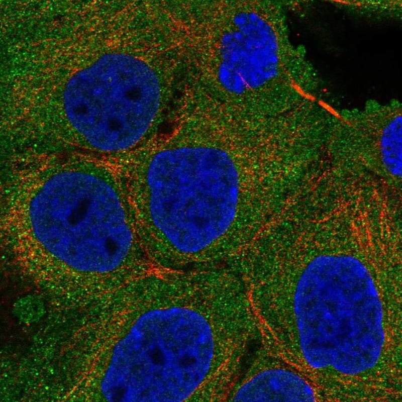 ACK1 Antibody Immunocytochemistry/Immunofluorescence: ACK1 Antibody [NBP3-25262]