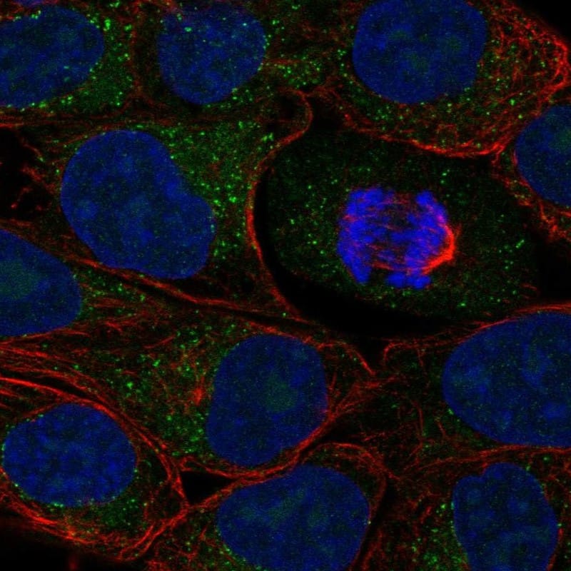 ACSL1 Antibody - BSA Free Immunocytochemistry/ Immunofluorescence: ACSL1 Antibody [NBP3-25263]