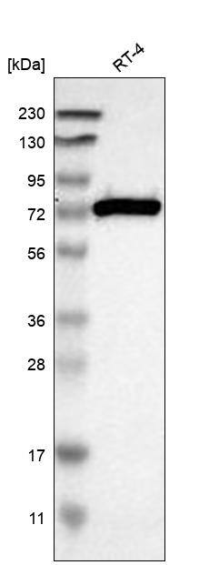ACSL1 Antibody Western Blot: ACSL1 Antibody [NBP3-25263]