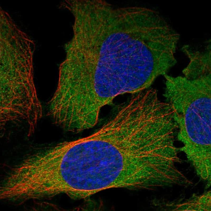 Activin C/Inhibin beta C Antibody Immunocytochemistry/Immunofluorescence: Activin C/Inhibin beta C Antibody [NBP3-25264]