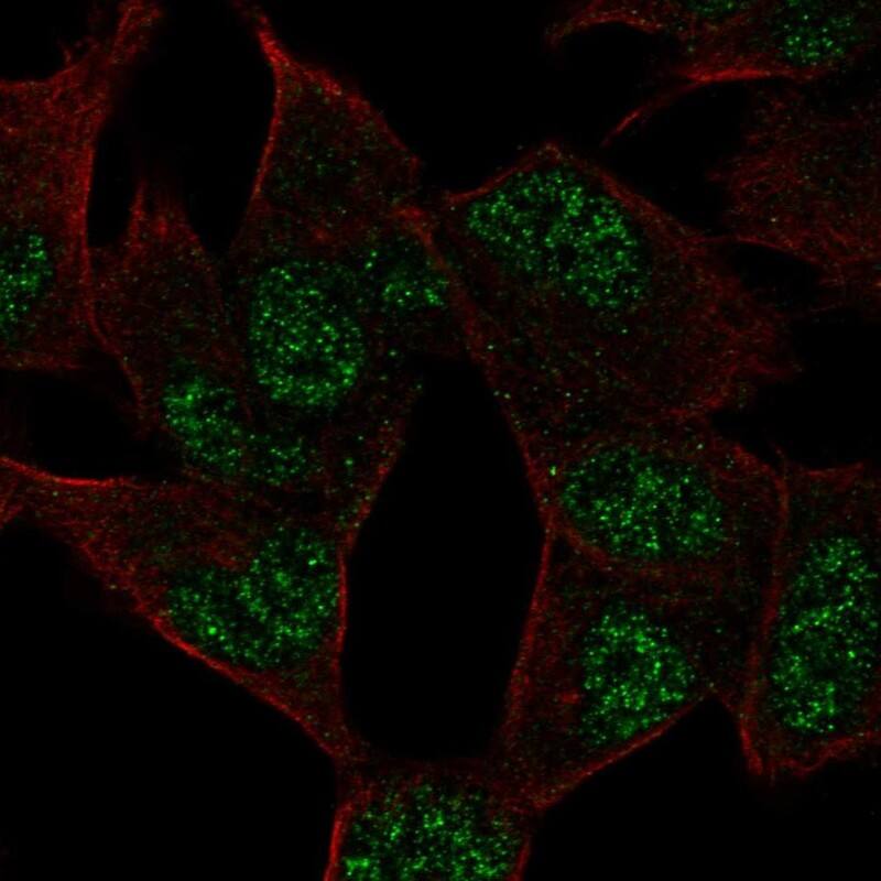 ADPRM Antibody Immunocytochemistry/Immunofluorescence: ADPRM Antibody [NBP3-25266]