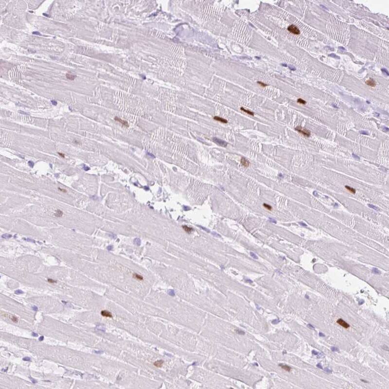 ADSSL1 Antibody Immunohistochemistry-Paraffin: ADSSL1 Antibody [NBP3-25267]