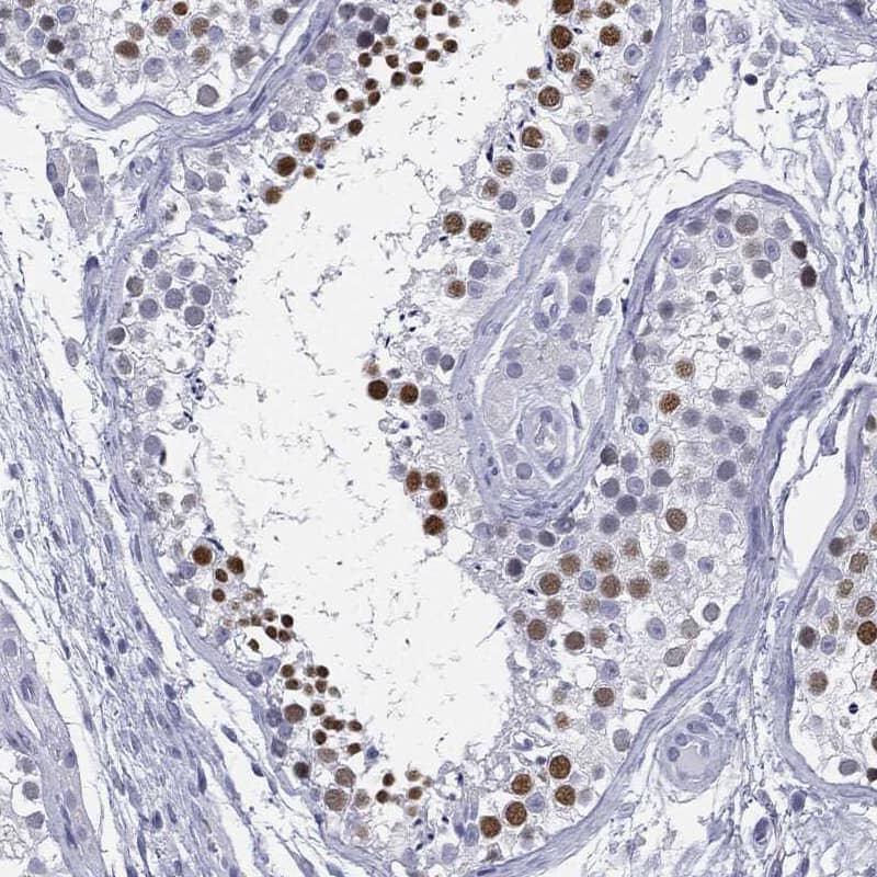 AF10 Antibody Immunohistochemistry-Paraffin: AF10 Antibody [NBP3-25268]