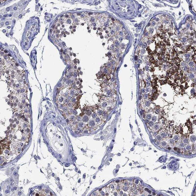 AKAP3 Antibody Immunohistochemistry-Paraffin: AKAP3 Antibody [NBP3-25270]