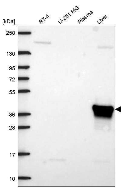 Aldolase B Antibody Western Blot: Aldolase B Antibody [NBP3-25271]