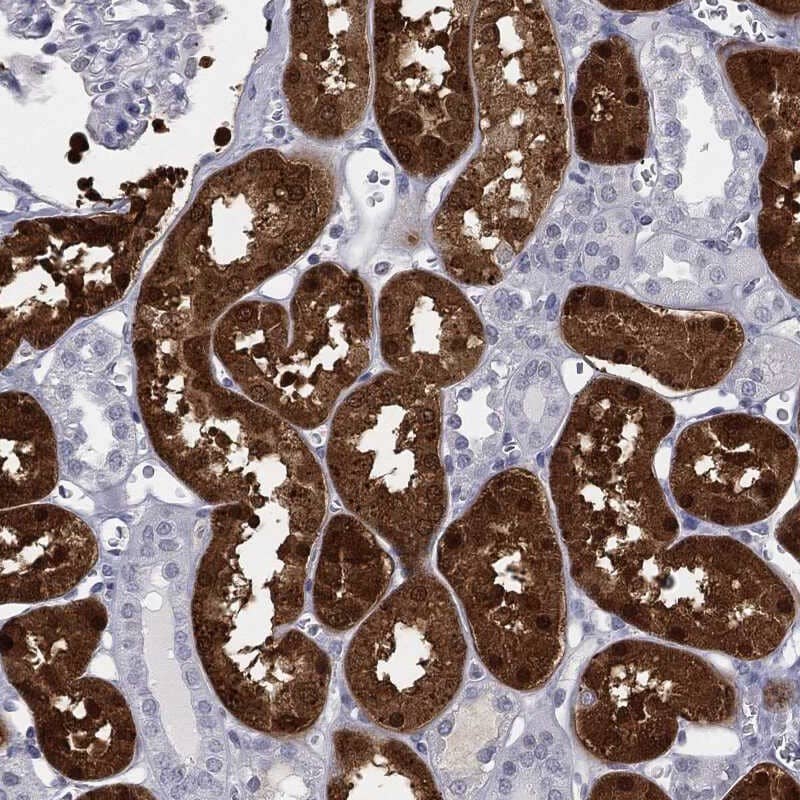 Aldolase B Antibody Immunohistochemistry-Paraffin: Aldolase B Antibody [NBP3-25271]