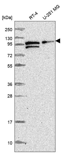 Alix Antibody Western Blot: Alix Antibody [NBP3-25272]