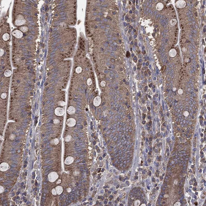 Alix Antibody Immunohistochemistry-Paraffin: Alix Antibody [NBP3-25272]