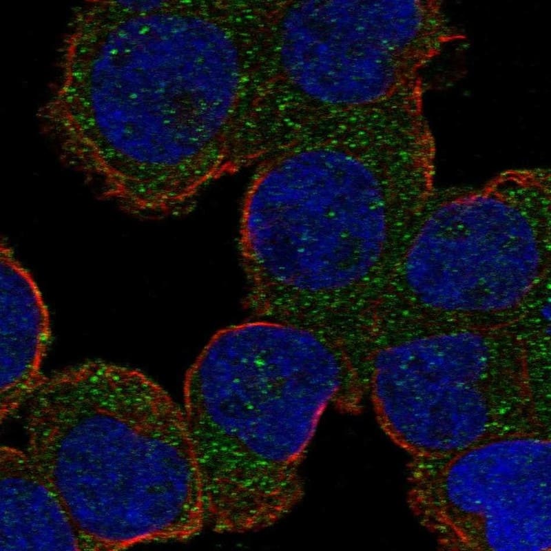 Als2 Antibody Immunocytochemistry/Immunofluorescence: Als2 Antibody [NBP3-25273]