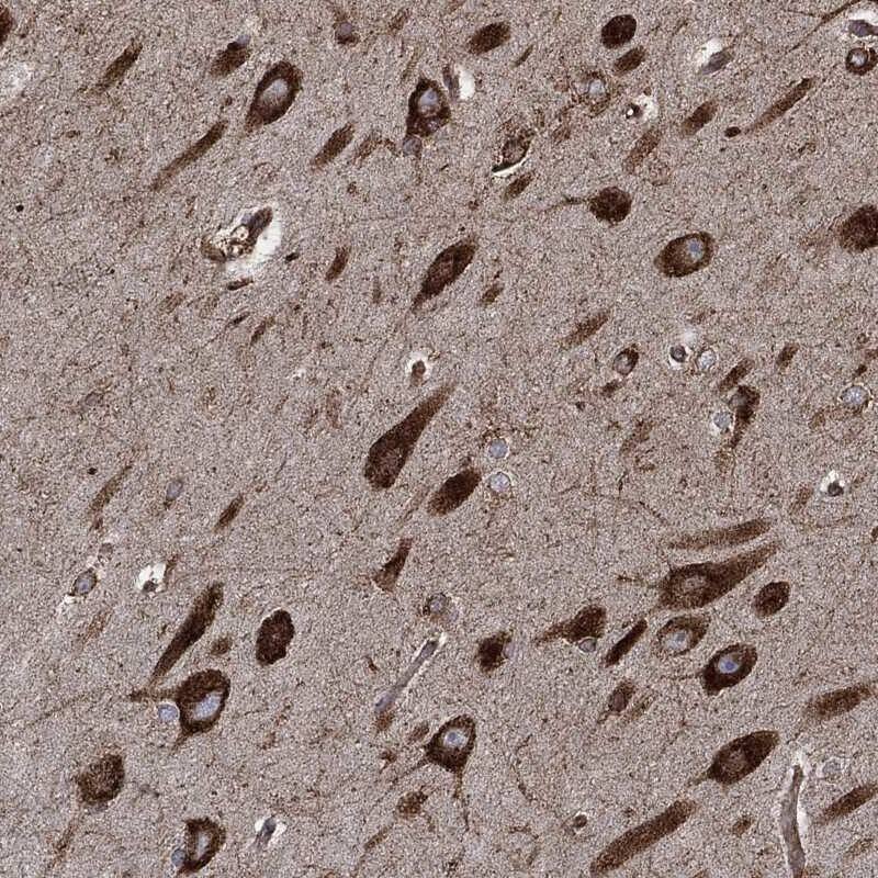 AMFR/gp78 Antibody Immunohistochemistry-Paraffin: AMFR/gp78 Antibody [NBP3-25274]