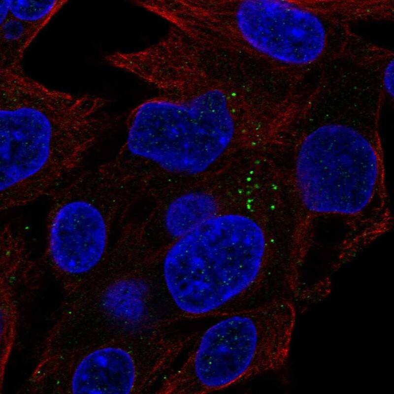 Aminoacylase/ACY1 Antibody Immunocytochemistry/Immunofluorescence: Aminoacylase/ACY1 Antibody [NBP3-25276]