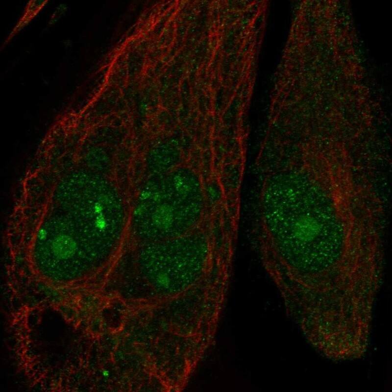 ANKRD30B Antibody Immunocytochemistry/Immunofluorescence: ANKRD30B Antibody [NBP3-25277]