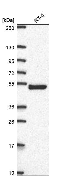 AP1M2 Antibody Western Blot: AP1M2 Antibody [NBP3-25278]