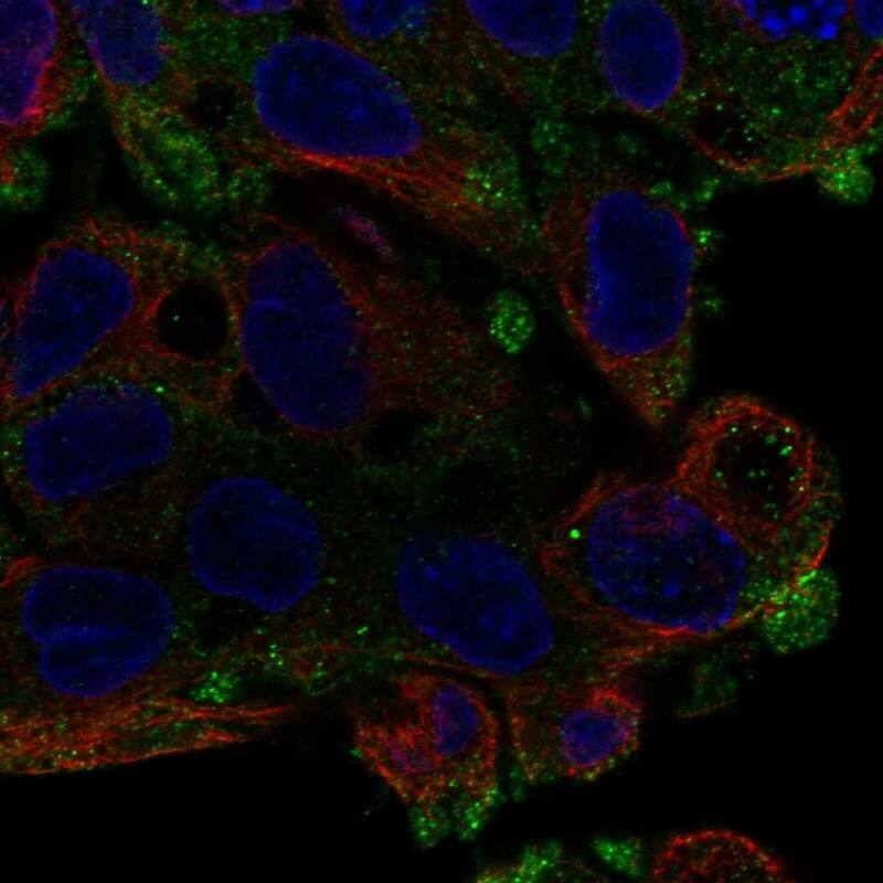 Aquaporin-11 Antibody Immunocytochemistry/Immunofluorescence: Aquaporin-11 Antibody [NBP3-25280]