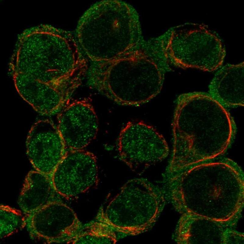 ARHGAP15 Antibody Immunocytochemistry/Immunofluorescence: ARHGAP15 Antibody [NBP3-25282]