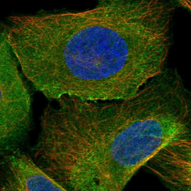 ARL9 Antibody Immunocytochemistry/Immunofluorescence: ARL9 Antibody [NBP3-25286]