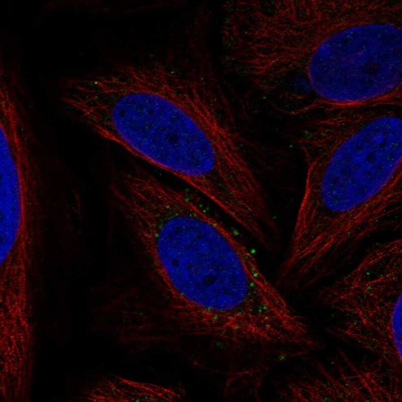 ATG12 Antibody Immunocytochemistry/Immunofluorescence: ATG12 Antibody [NBP3-25289]