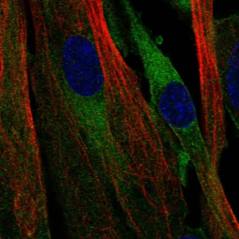 ATP8B2 Antibody Immunocytochemistry/Immunofluorescence: ATP8B2 Antibody [NBP3-25291]