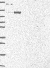 Axin-1 Antibody Western Blot: Axin-1 Antibody [NBP3-25292]