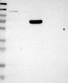 B3GALNT2 Antibody Western Blot: B3GALNT2 Antibody [NBP3-25293]