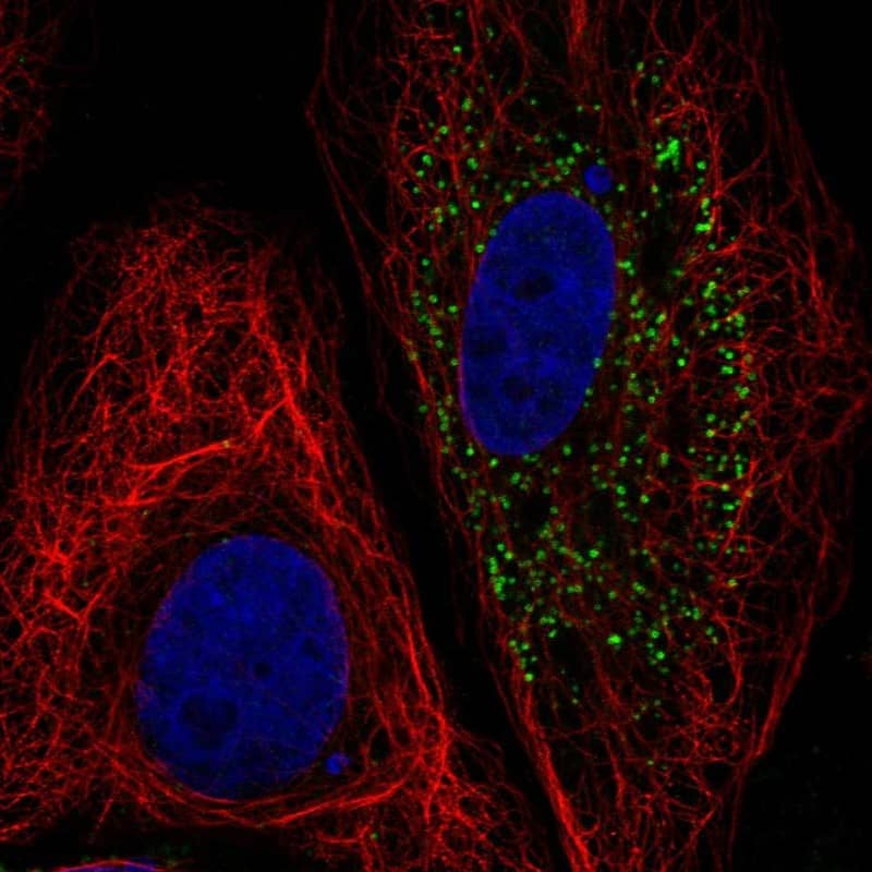 B4GALT5 Antibody Immunocytochemistry/Immunofluorescence: B4GALT5 Antibody [NBP3-25294]